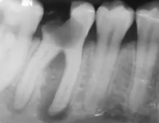 <p>how would you describe the border of this lesion </p>