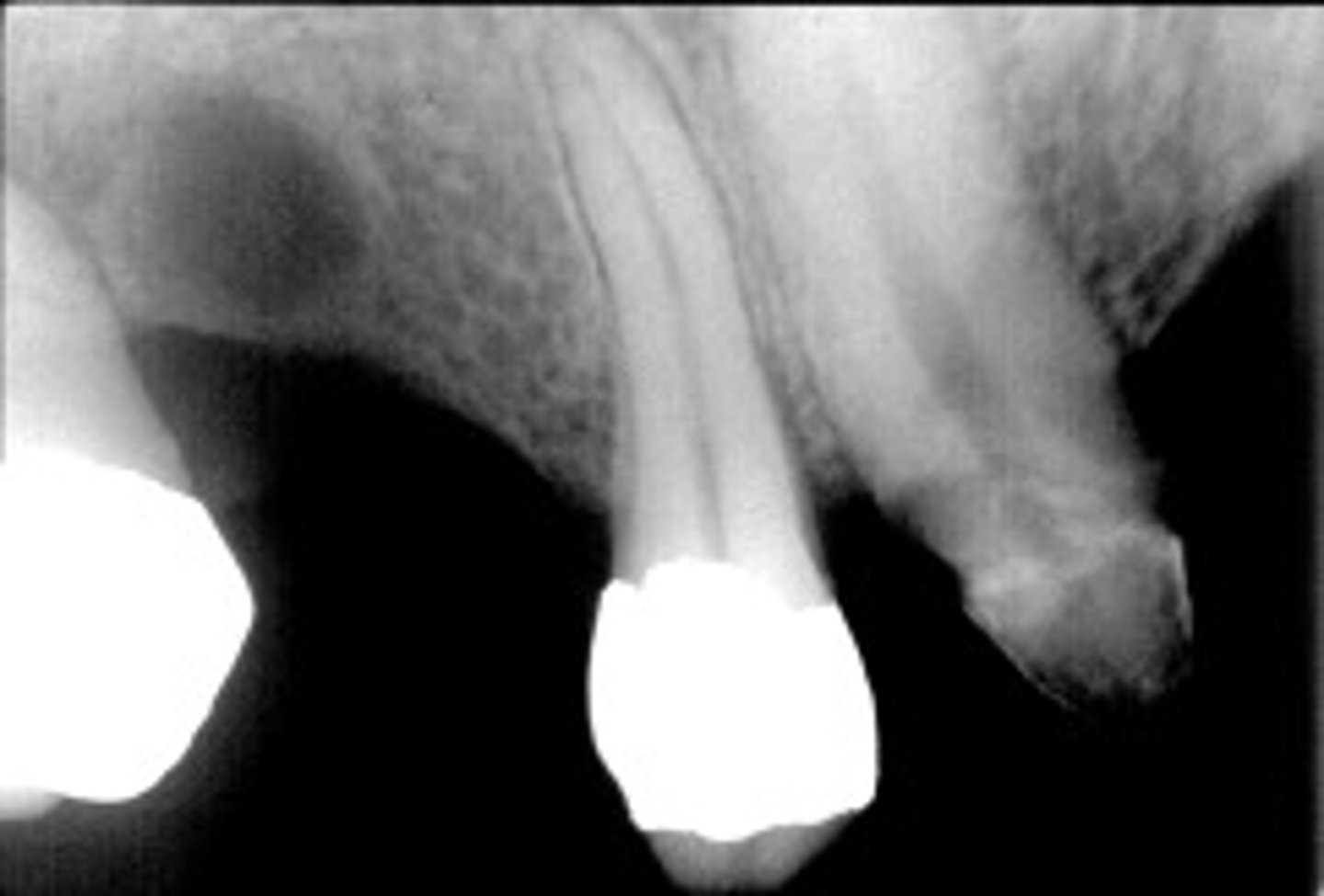 <p>ID the cyst:</p>