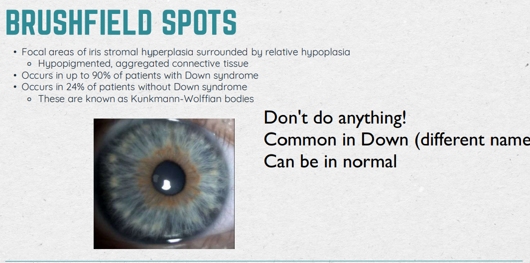 <ul><li><p>Don’t do anything!</p></li><li><p>Common in patients with Down Syndrome (90%)</p></li><li><p>Can be in normal patients (24%)</p></li></ul><p></p>