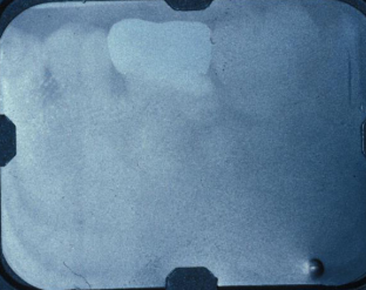 <p>- Fixer time or temperature too low</p><p>- Radiograph opaque</p>