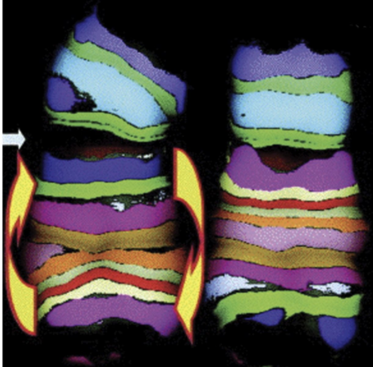 <p>when part of the chromosome becomes oriented in the reverse of its usual direction</p><p>- note specificity achieved: break location and inversion clearly identifiable</p>