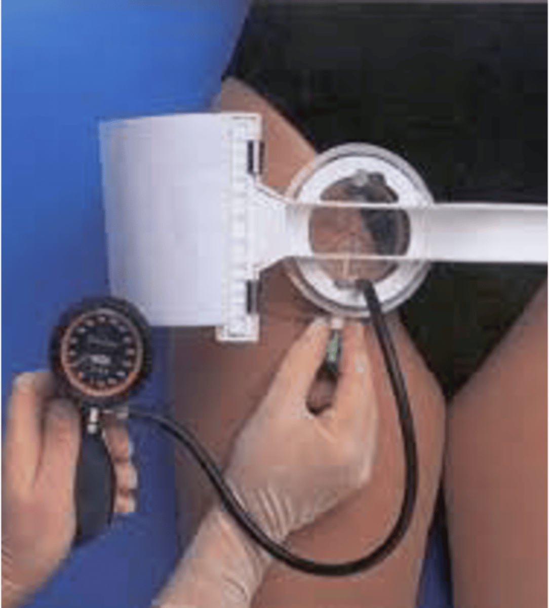 <p>puts pressure on femoral artery to help clot to form</p>