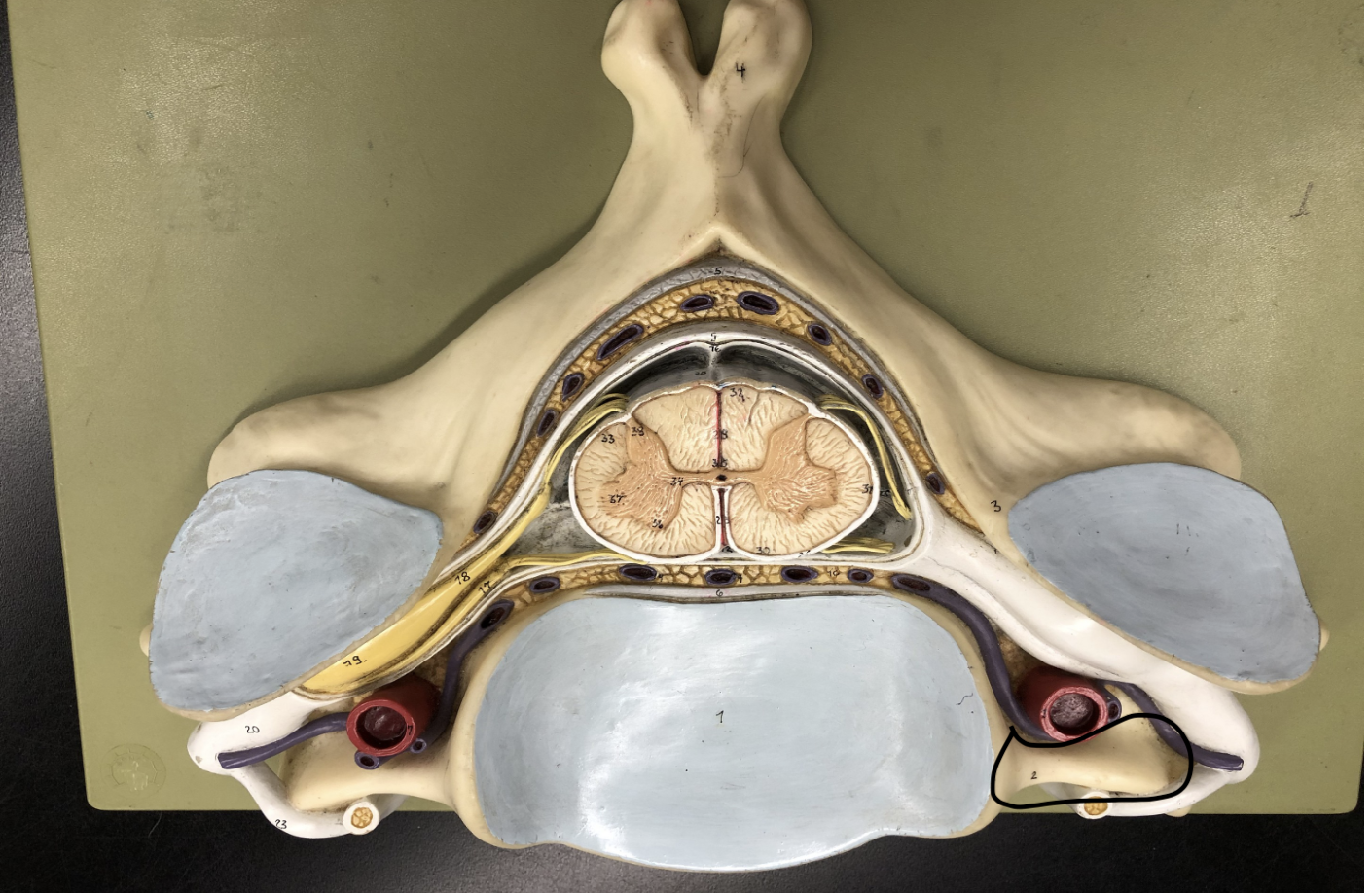 <p>what is this part of the vertebrae (of the spinal cord?)</p>