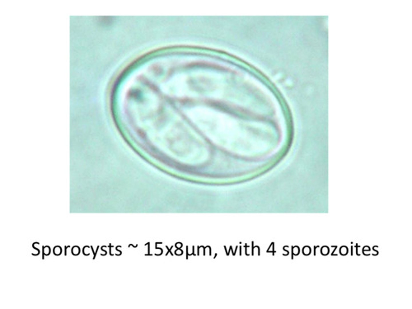<p>ID the following parasite</p>