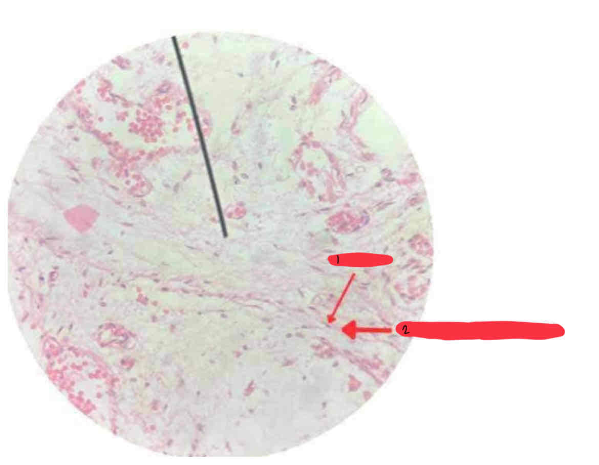 <p>Mesenchyme</p>