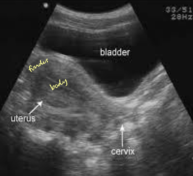 <p>is this uterus normal?</p>