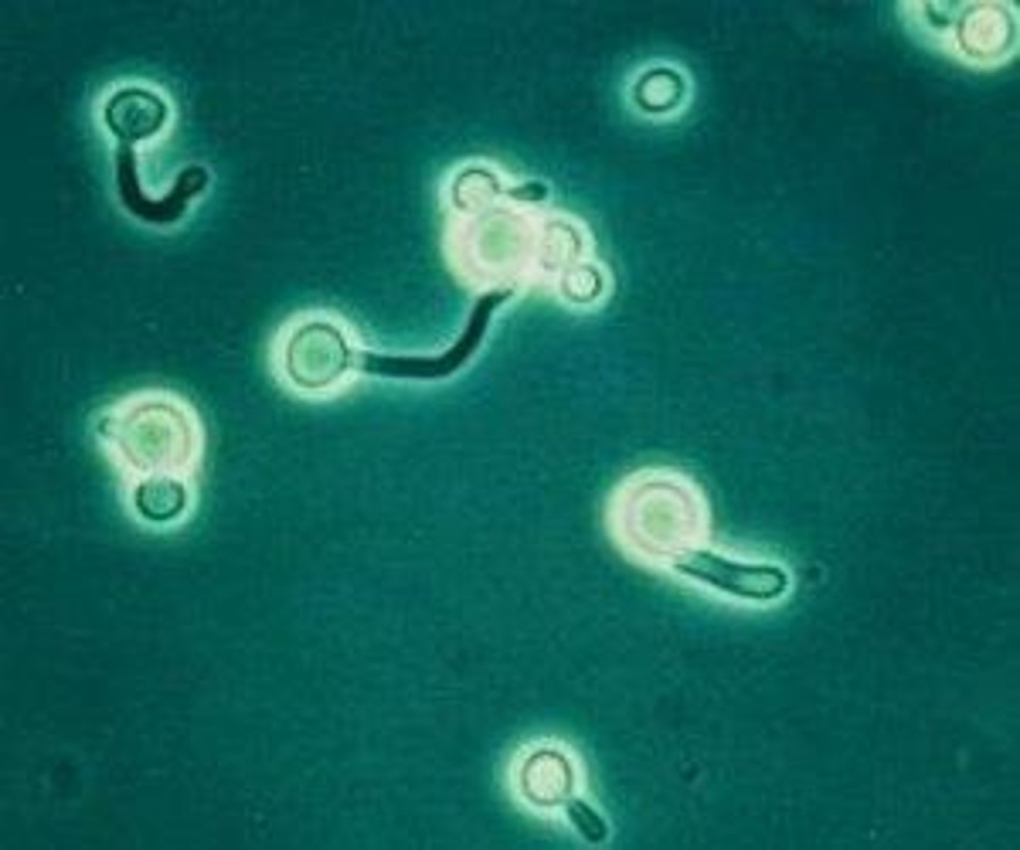 <p>Tubular structures without septa just contstriction, seen in some yeasts.</p>
