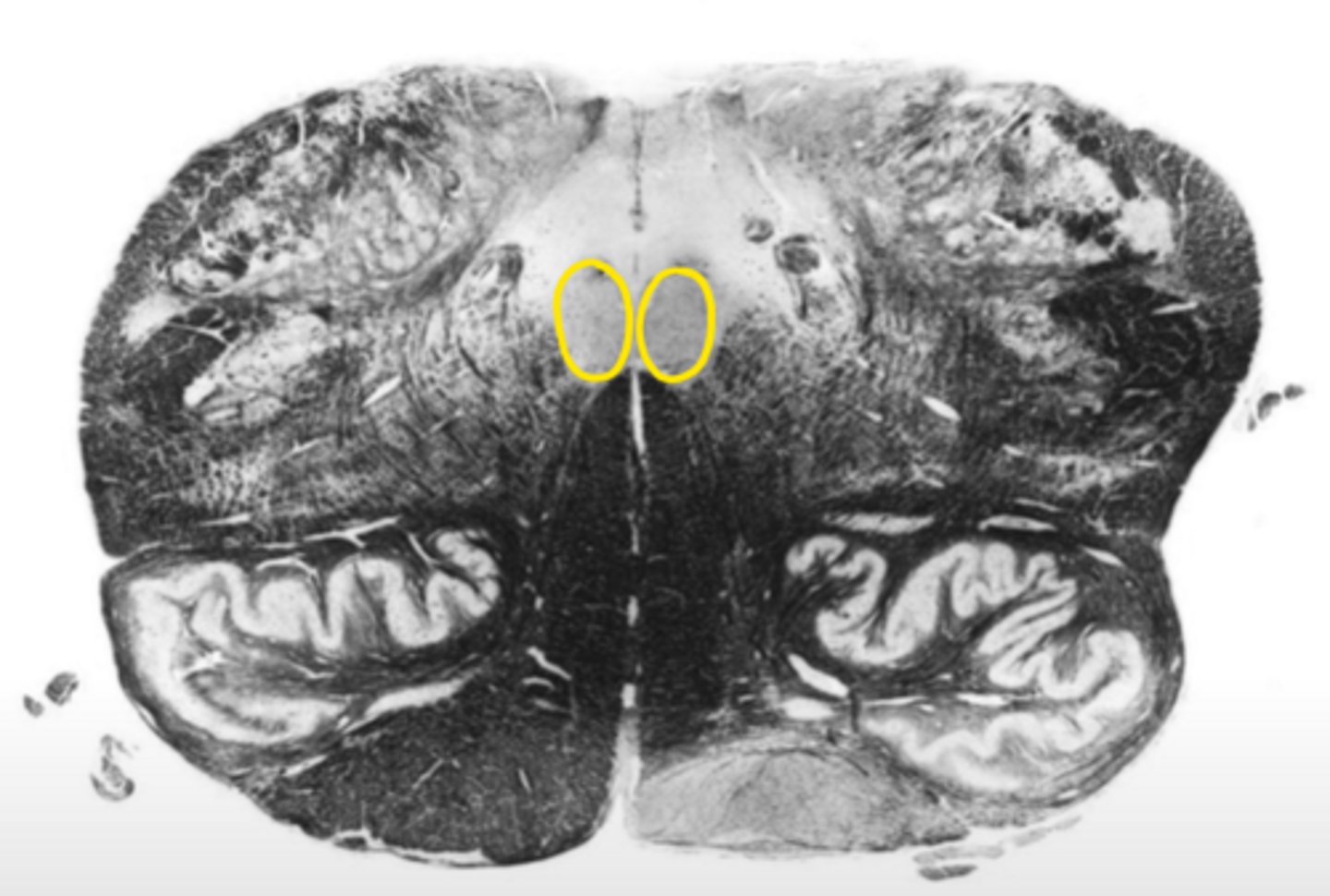 <p>ID the nucleus</p>