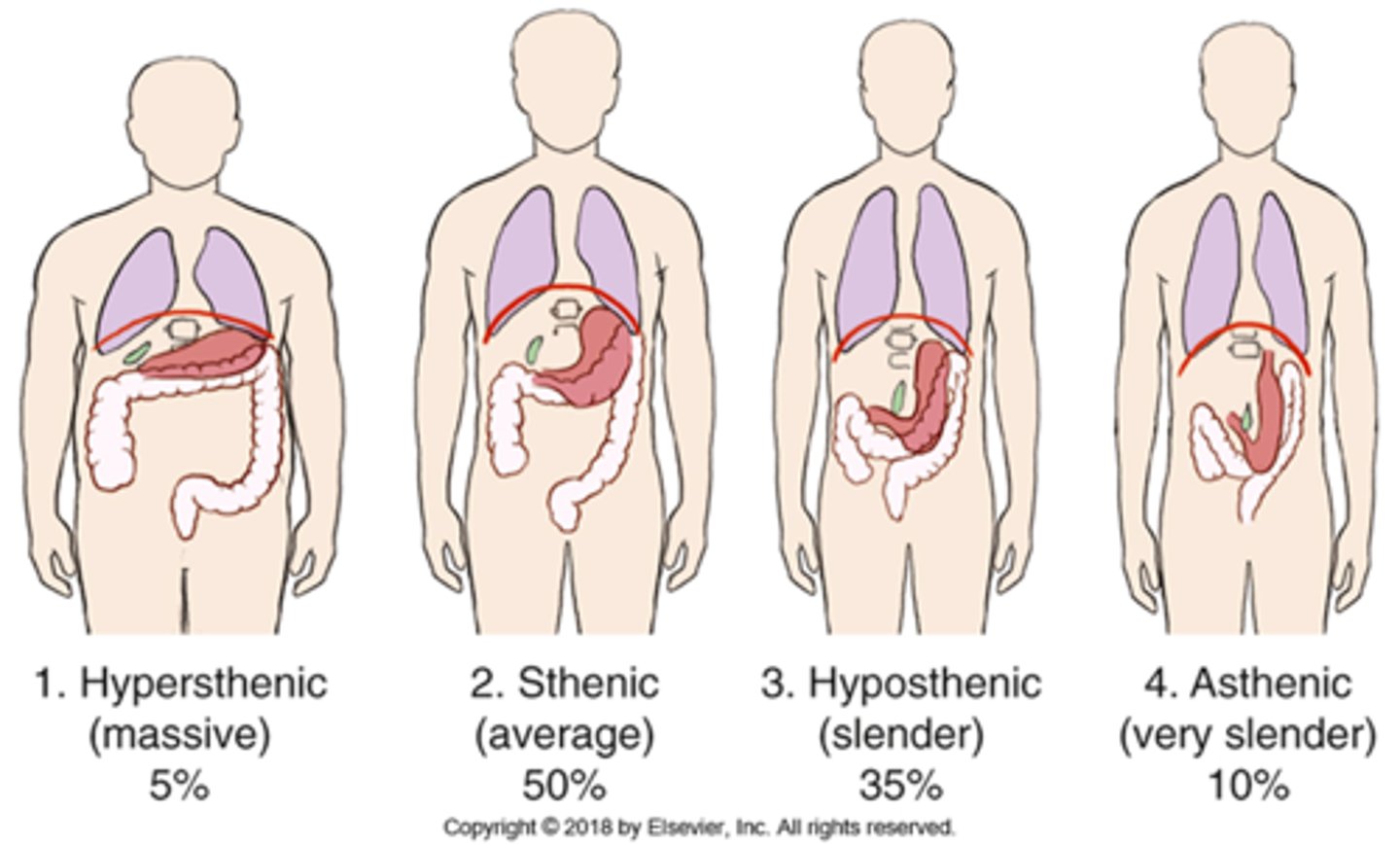 <p>D) hypersthenic</p>