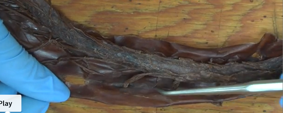 <p>The middle layer of the meninges.</p>