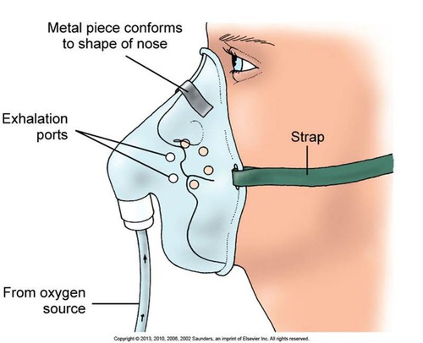<p>easily moveable</p><p>less restrictive then cpap and bipap</p><p>can be difficult to talk/eat</p><p>can feel smothering</p><p>- 5-10L</p><p>- 40-60%</p>