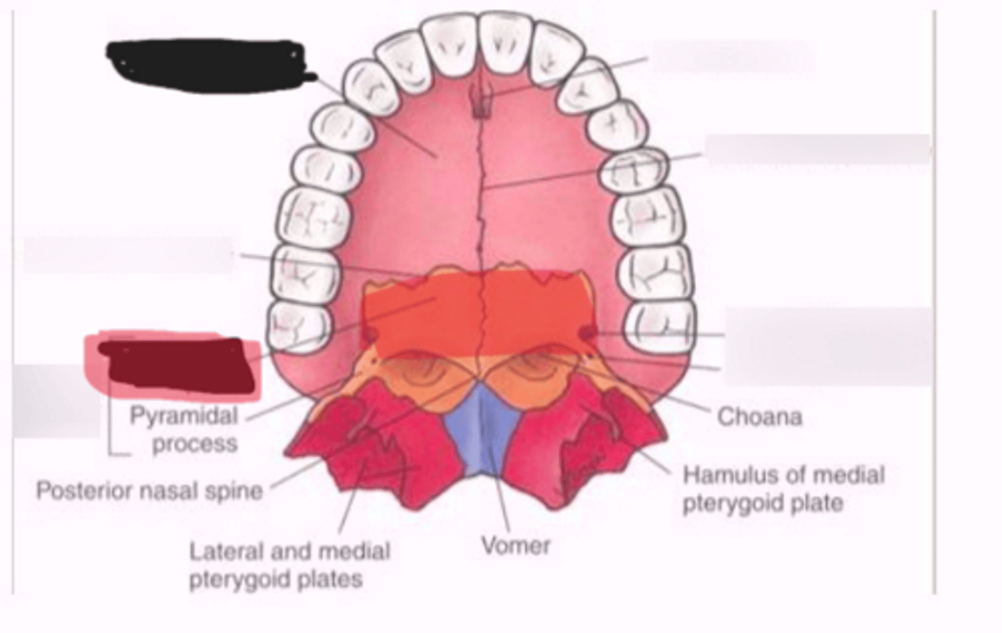 <p>Palatine bone</p>
