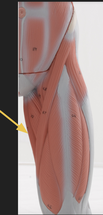 <p>identify + state origin, insertion, action, innervation of marked structure</p>