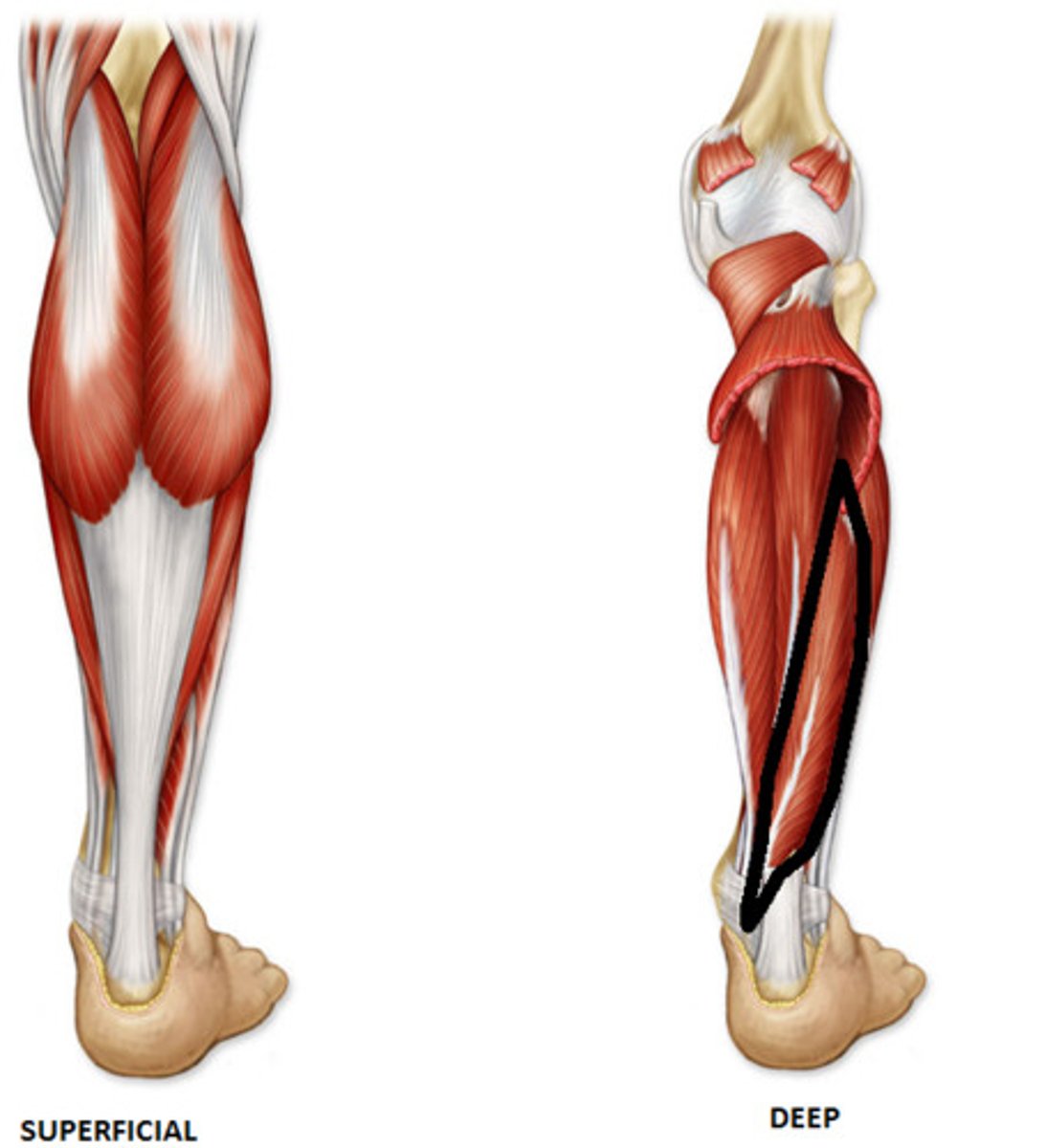 <p>Origin: middle 1/3 of posterior fibula</p><p>Insertion: distal phalanx I</p><p>Action: plantarflexes and inverts foot; flexes hallux</p>