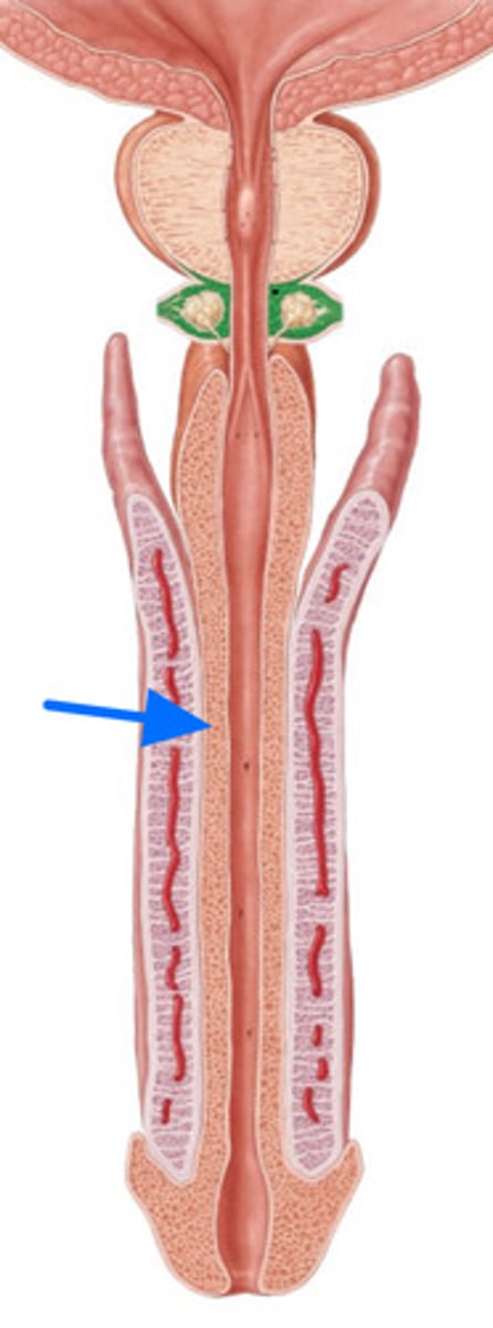 <p>ID Structure Marked with the Blue Arrow</p>