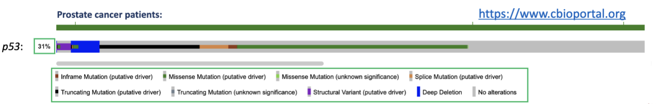 <p>prostate cancer </p><ul><li><p>These mutations are deleterious to p53 function; hence in cells that are p53 mutant:</p></li></ul><p>i. They are unable to pause G1-S transition if DNA damage is present</p><p>ii. They have reduced capacity to repair DNA</p><p>iii. Their apoptotic potential is compromised</p><ul><li><p>Interestingly, when p53 is wild-type, MDM2 gene amplification is often found in cancer which blocks p53 activity</p></li><li><p>ultimately, loss of p53 allows transmission of potentially cancerous genetic lesions to be transmitted to progeny</p></li></ul><p></p>