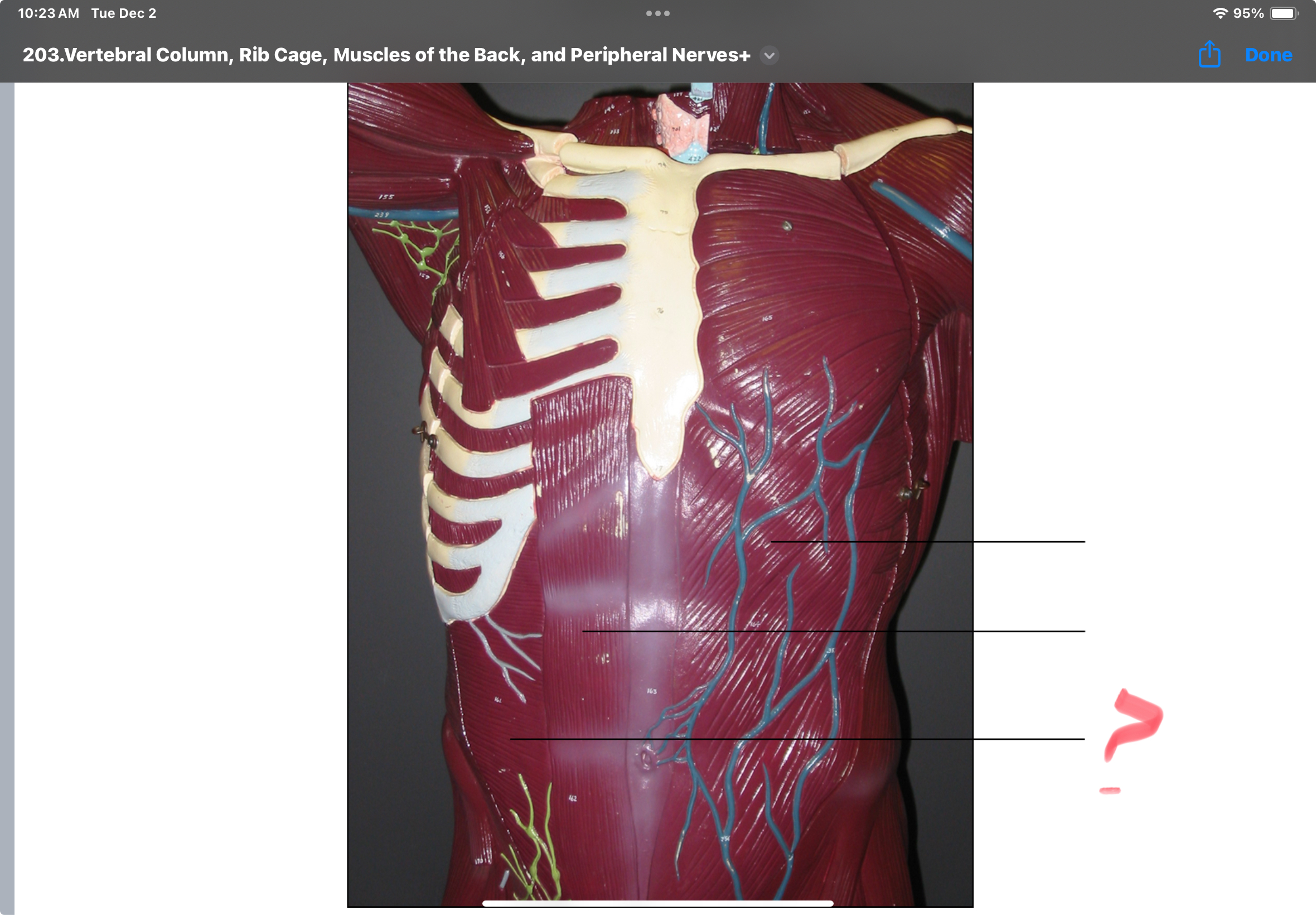 <p>Transversus abdominis Action: compresses abdomen</p>