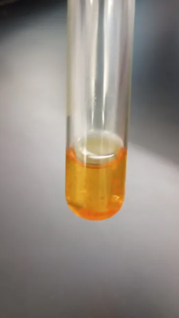 <ul><li><p><strong>Colors:</strong></p><ul><li><p>Red</p></li><li><p>Magenta</p></li><li><p>Orange-Red</p></li></ul></li></ul><p></p><p><strong>Explanation: </strong>This bacterium uses nitrate as a final electron acceptor during anaerobic respiration, reducing it to nitrite.</p>