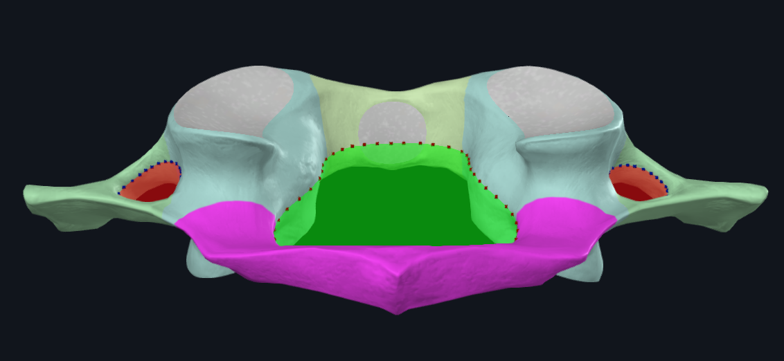 <p>name the bone and highlighted (pink)</p>