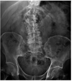 <p>What is this and what type of scan </p>