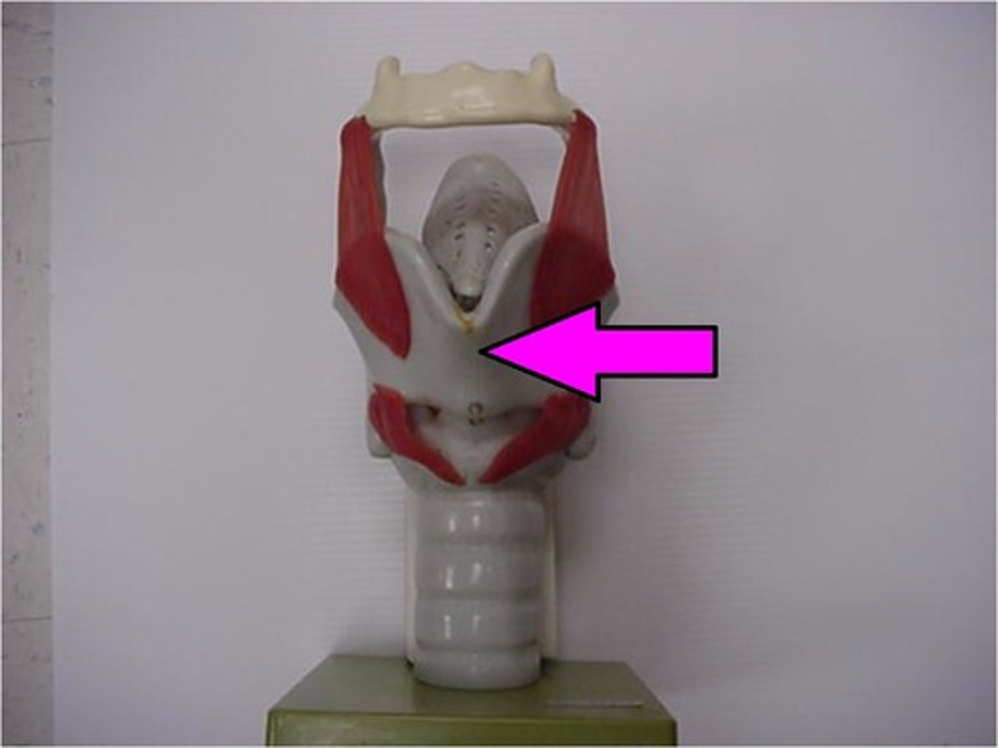 <p>The largest of the 9 cartilages of the larynx; AKA Adam's apple; lies just inferior to the hyoid bon at about the level of C3-C4</p>