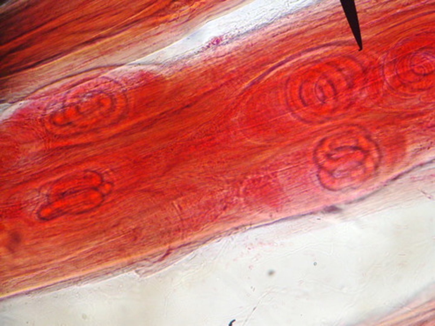 <p>Trichinosis (aka trichenellosis)</p><p>Helminth (nematoda, roundworm)</p><p>diagnosed via biopsy/serological testing</p>