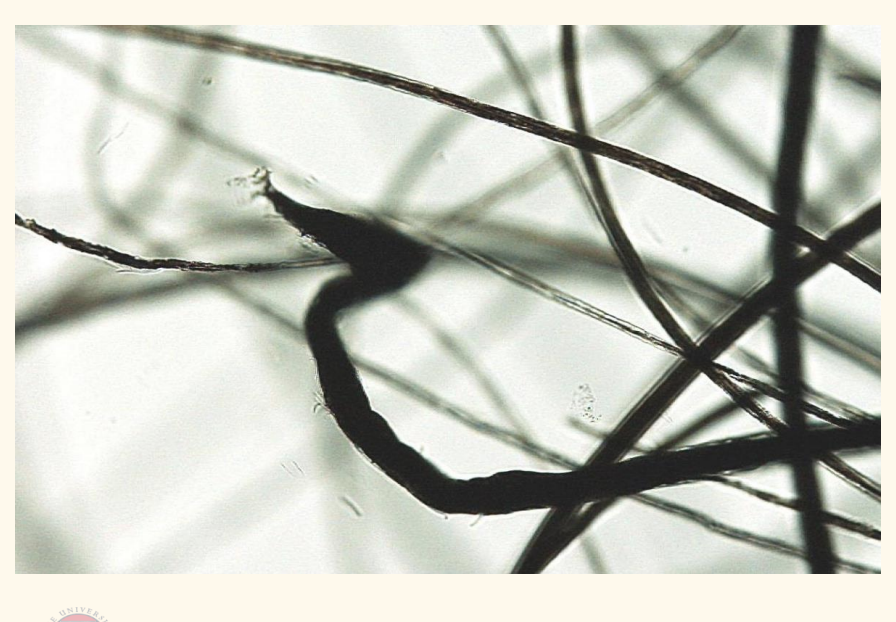 <p>What has happened to these hairs?</p><ul><li><p>This poodle developed alopecia following treatment with prednisolone &amp; azathioprine for IBD</p></li></ul><p></p>