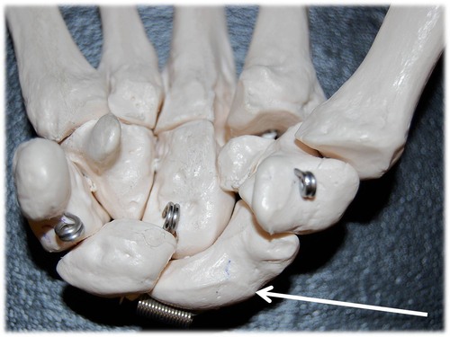 Name this specific bone of the hand (anterior view).