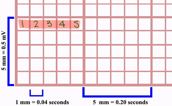 <p>5 small squares</p>