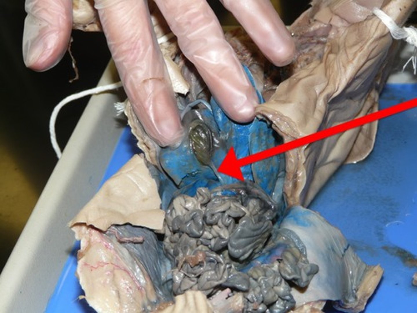 <p>Leads to small intestine</p><p>Bile is sent from the gall bladder to this structure in order to emulsify fat.</p>