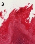 <p>what type of papillae?</p>