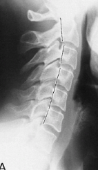 <p>Q what is the name of this measurement? and what is the average + range?</p>