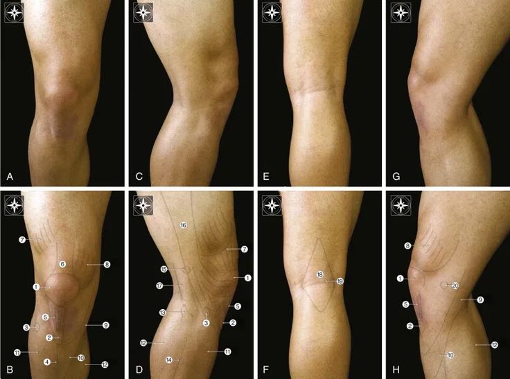 <p>Back of knee</p>