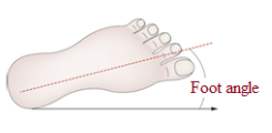 <p></p><p>an angle between the line of progression and a line drawn between the midpoints of the calcaneus and the second metatarsal head</p>