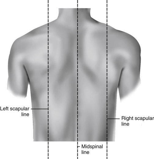 <p>Anterior: Right / left midclavicular line, midsternal line</p><p>Posterior: left/right scapular line, midspinal line</p>
