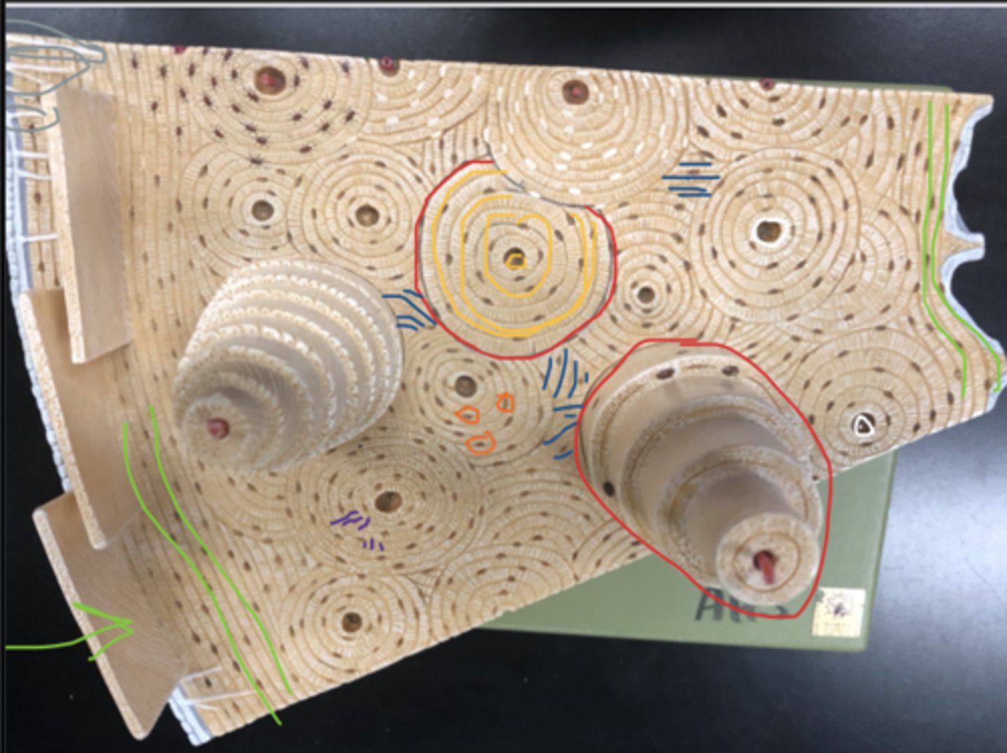 <p>What is circled in yellow</p>