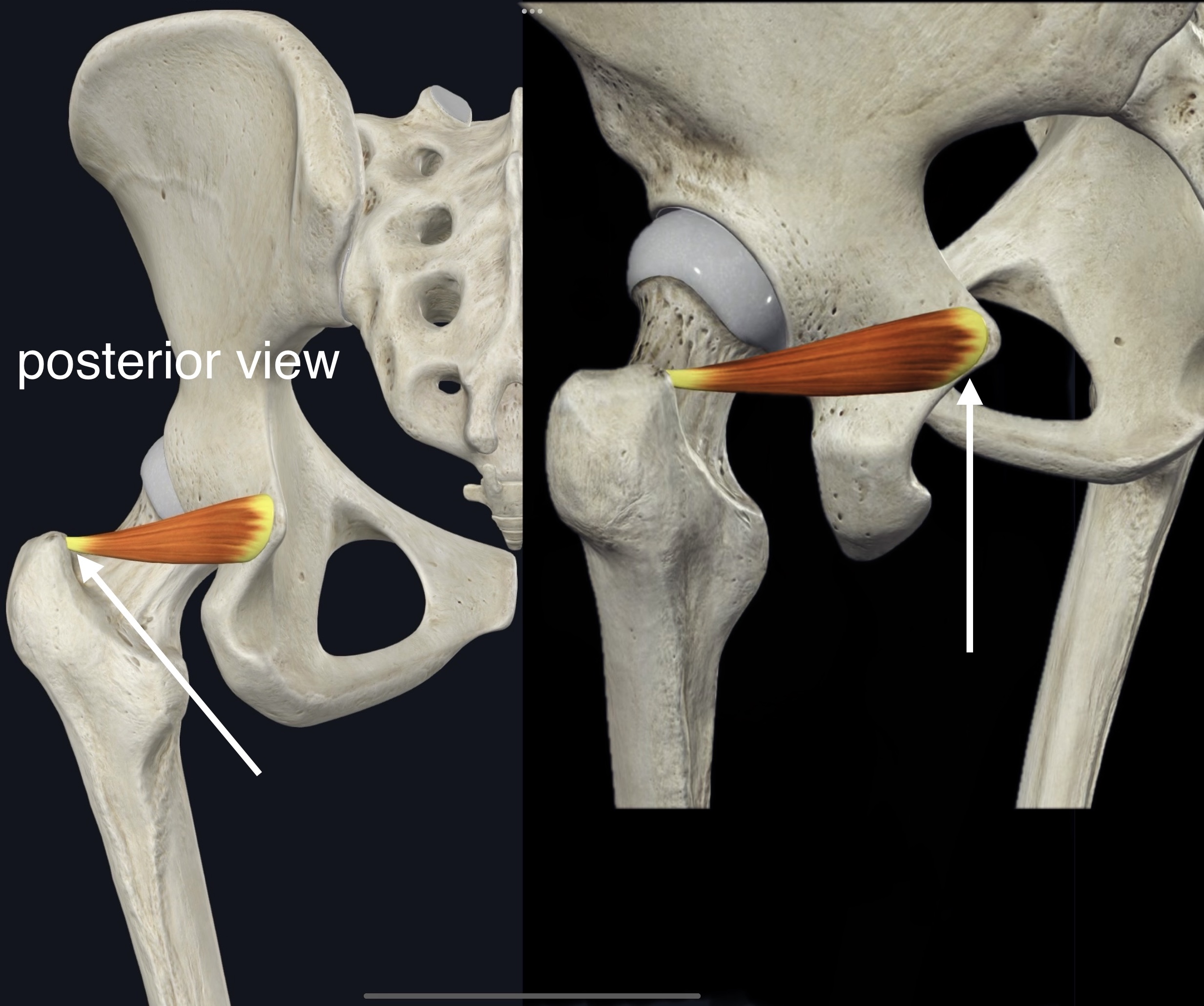 <p>Name the muscle, origin and insertion</p>