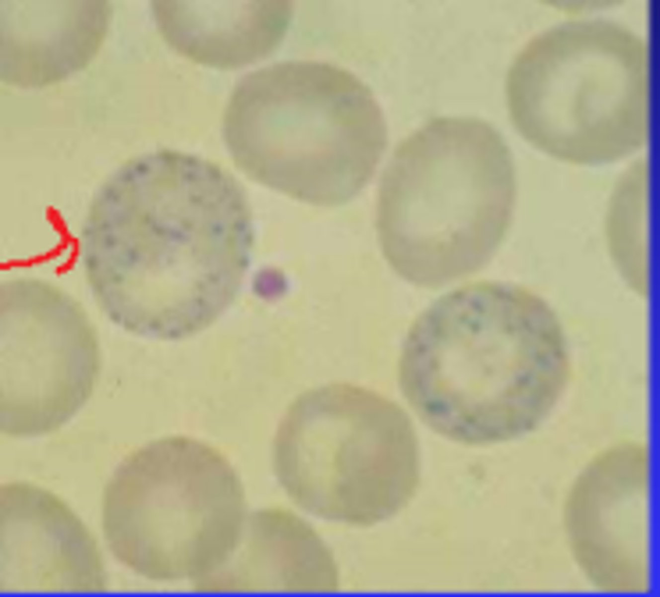 <p>- dark speckles</p><p>- rumintants/cats with anemia</p>