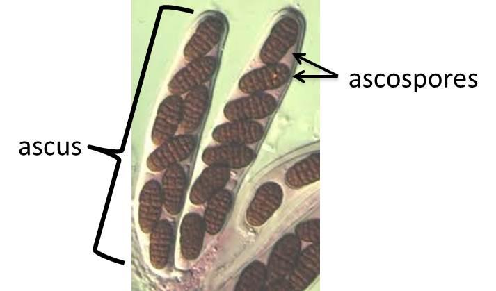<p>Asci + ascospores</p>