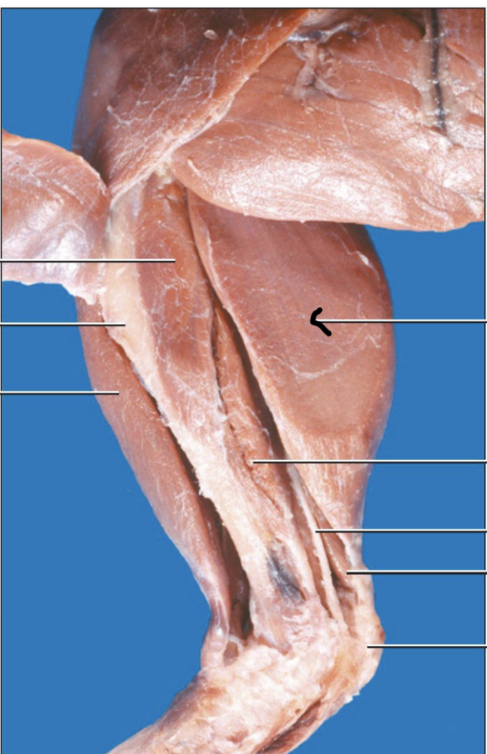 What is the arrow pointing to?