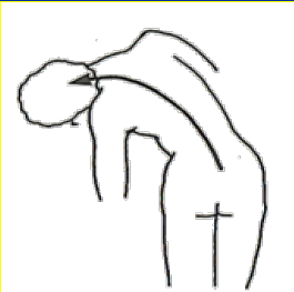 <p>What Movement is occurring?</p>