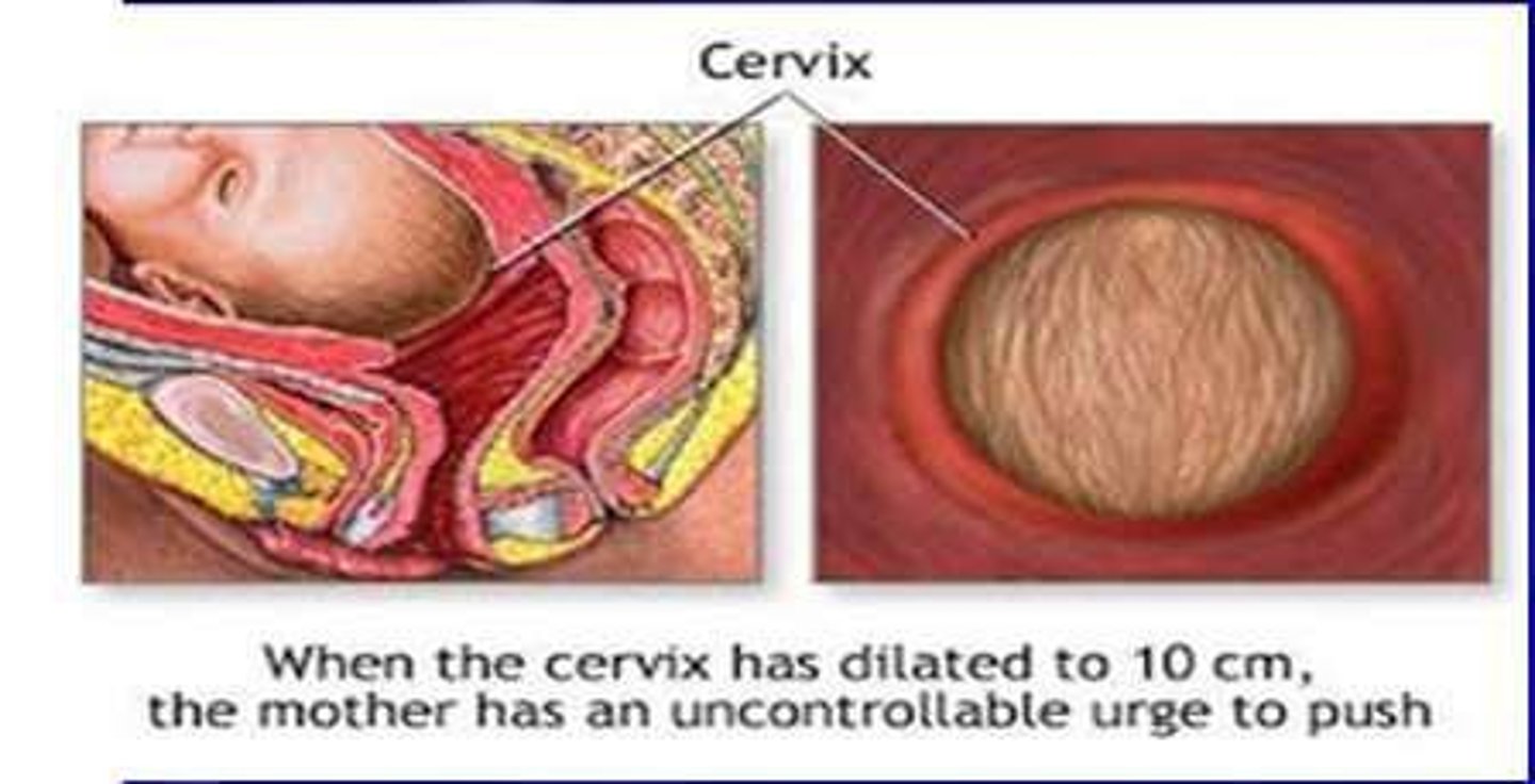 <p>Longest stage; cervical dilation to 10 cm.</p>