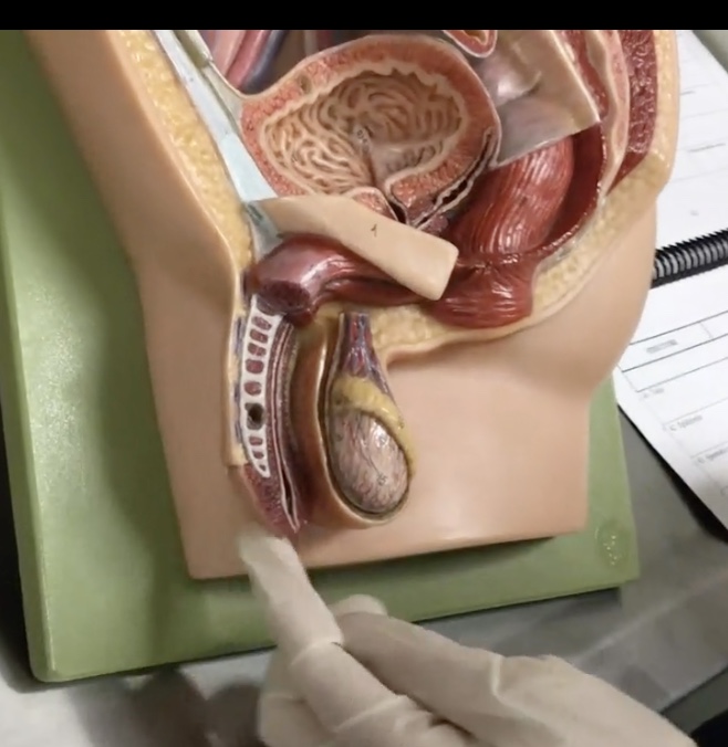 <p>Description: Expanded tip of penis composed of corpus spongiosum</p><p>Relationship: Contains the spongy urethra</p>