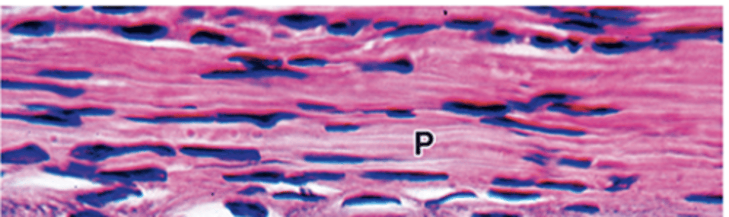 <p>What type of connective tissue makes up the perichondrium?</p>