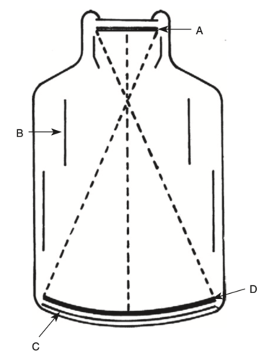 <p>Where is x-ray energy converted to visible light?</p><p>a. A</p><p>b. B</p><p>c. C</p><p>d. D</p>