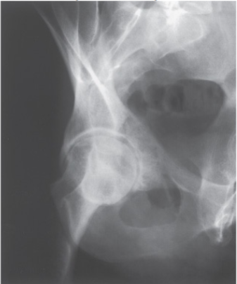 <p>What is the projection and anatomy shown in this image?</p>