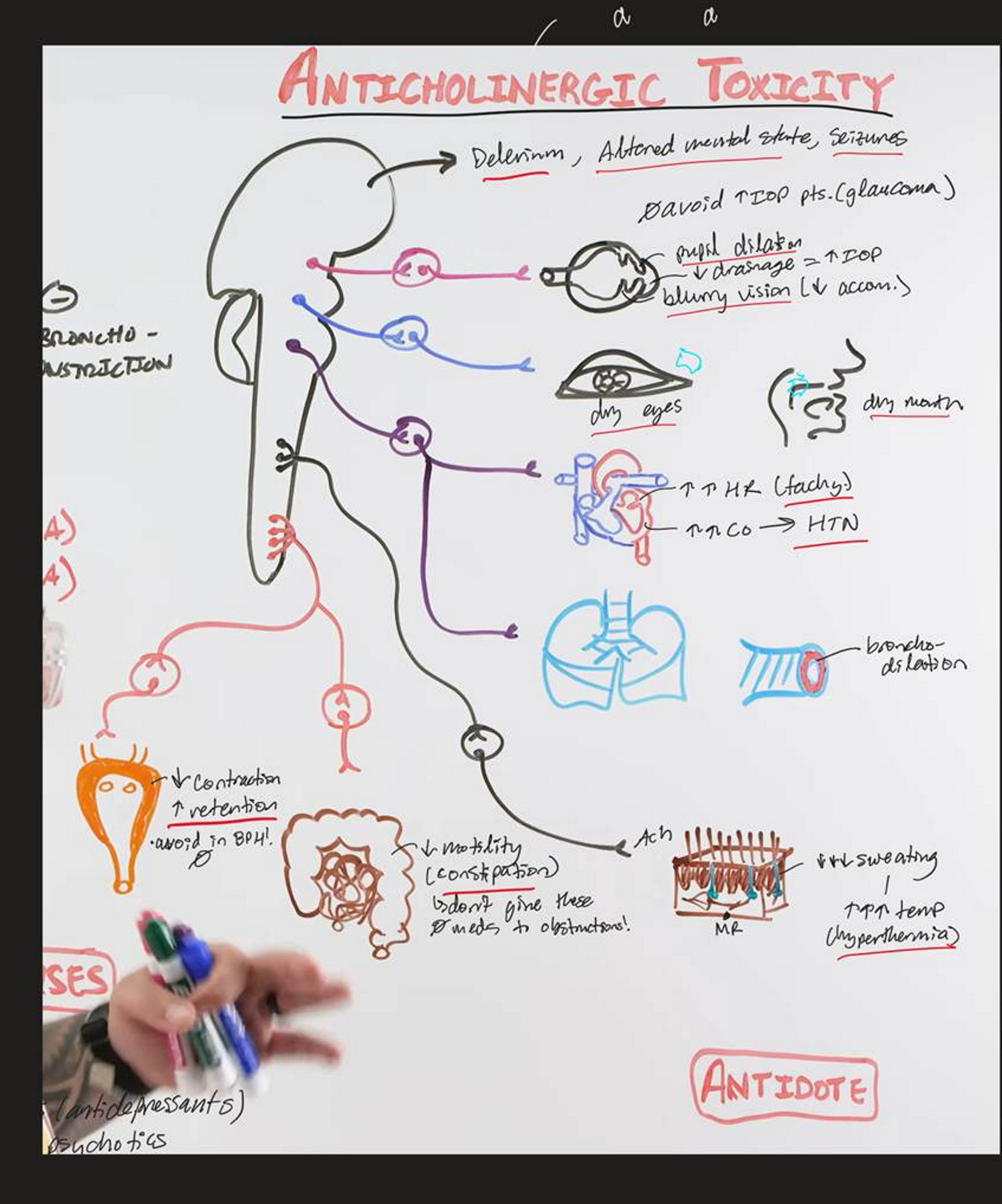 <p>Caused by:</p><ul><li><p>Too little ACh means no CNS stimulation, you can’t sweat (so your temp rises), you turn red, your mucous membranes can’t secrete anything</p></li></ul><p>“Mad as a hatter</p><p>Red as a beet</p><p>Hot has a hare</p><p>Dry as a bone”</p><p>Tx:</p><ul><li><p>Cholinesterase inhibitors (physostigmine!)</p></li></ul><p></p>