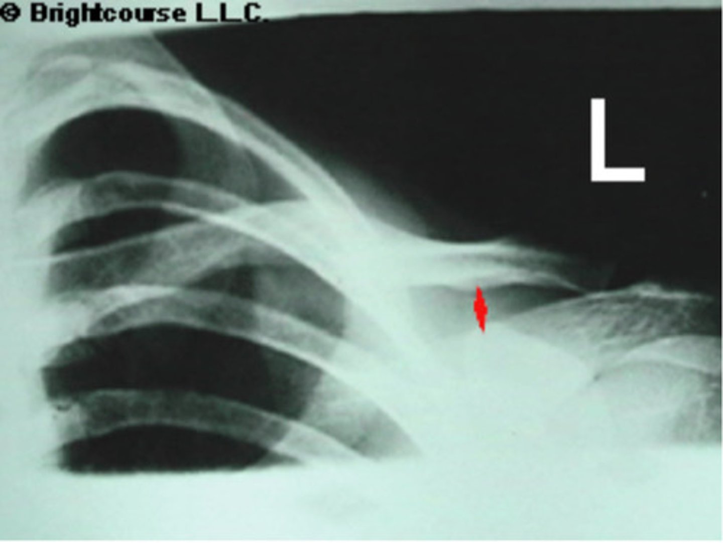 <p>What is being pointed out by the arrow in the image?</p>