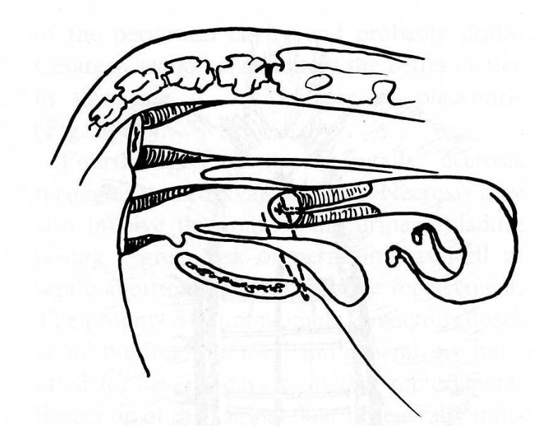 <p>what is this fixation method?</p>