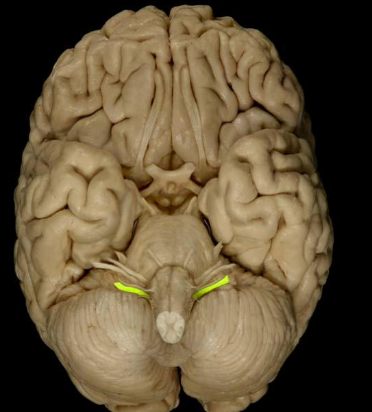 <p>List the nerve name, roman numeral, and function.</p>